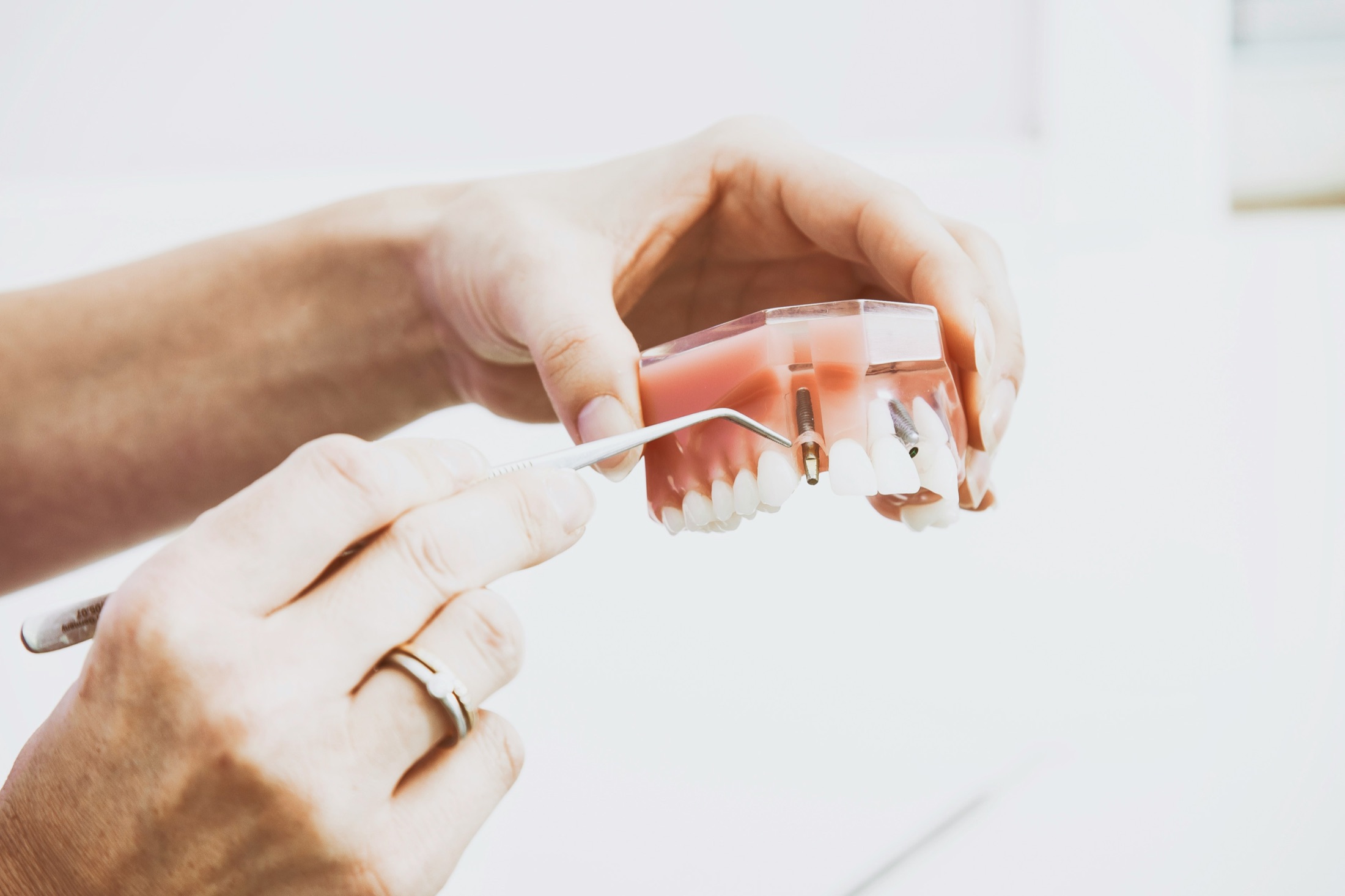 Dental Implant Restoration